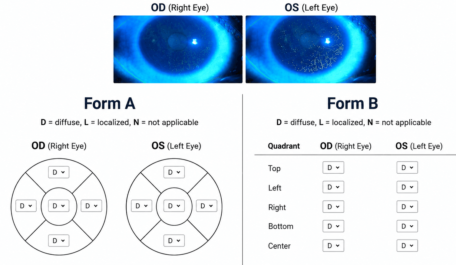 Fluorescein images of the right (OD) and left (OS) eye above two data-entry forms. Form A is two circles divided into top, left, right, bottom and centre regions, each holding a dropdown, laid out in the same left-to-right order as the images above. Form B is a table with quadrant rows (top, left, right, bottom, centre) and separate OD and OS columns.
